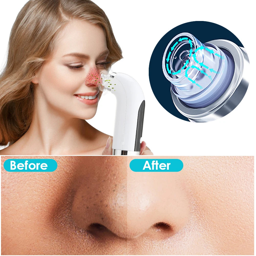 Electric Blackhead Remover Vacuum Suction Pore Cleaner Acne Pimple Black Head Dots Extractor Facial Cleaning Skin Care Korean