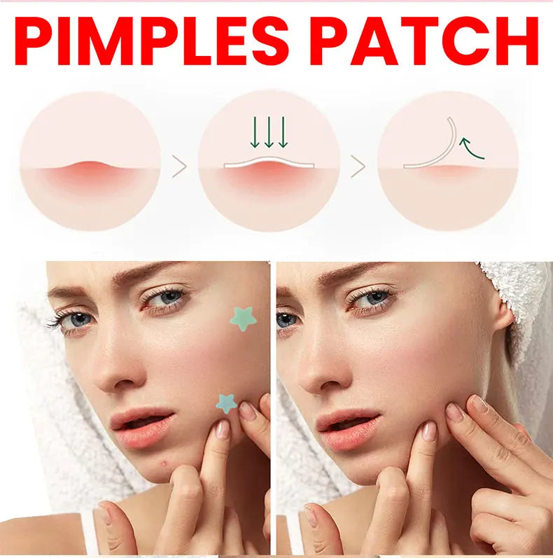 Repair Acne Patch Facial Skin Care Fade Blemishes Pimple Marks Closed Acne Blemishes Cover Acne Pimple Repair Patch