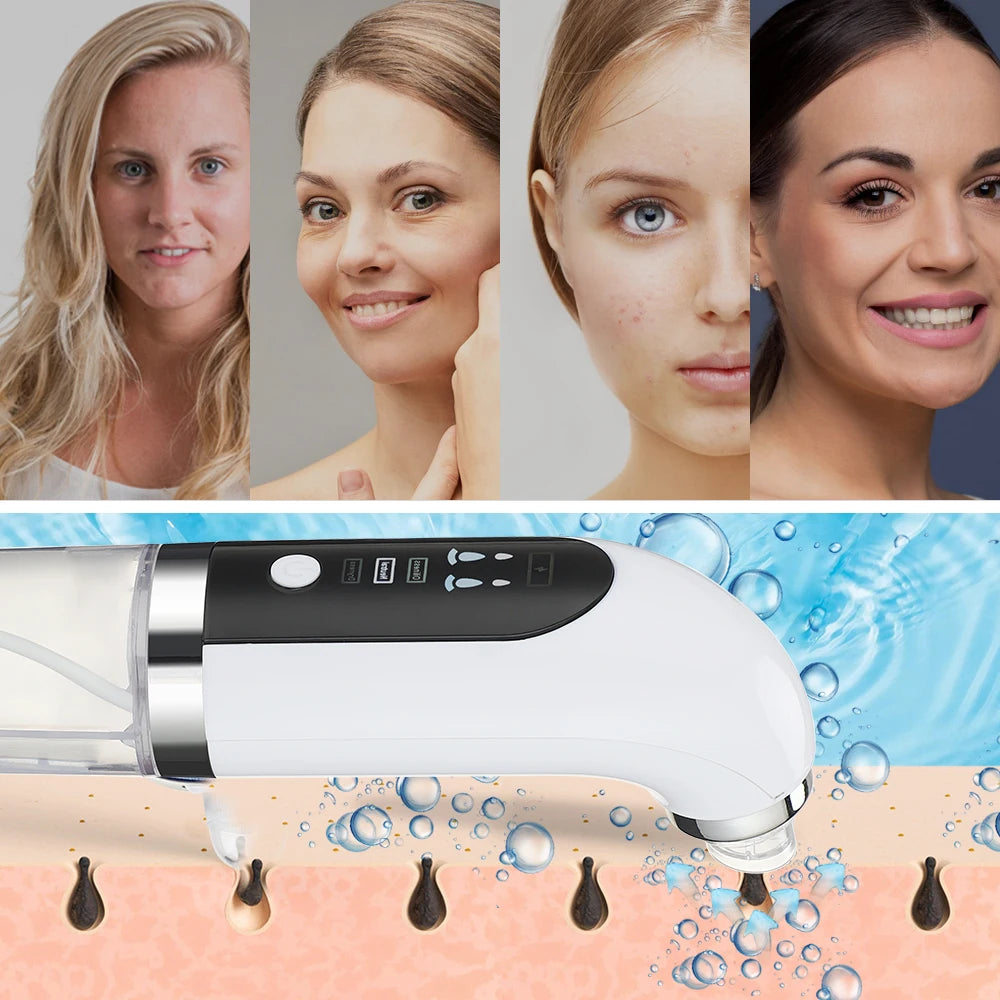 Electric Blackhead Remover Vacuum Suction Pore Cleaner Acne Pimple Black Head Dots Extractor Facial Cleaning Skin Care Korean