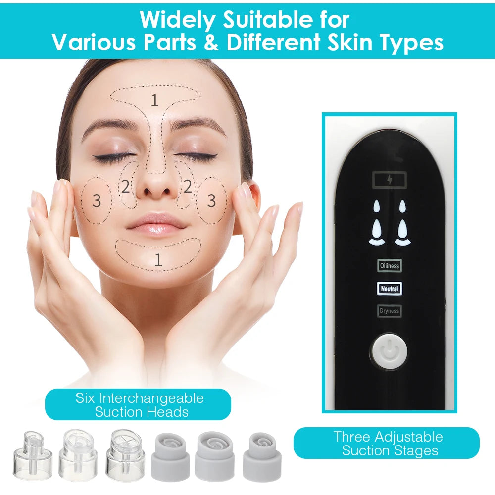 Electric Blackhead Remover Vacuum Suction Pore Cleaner Acne Pimple Black Head Dots Extractor Facial Cleaning Skin Care Korean